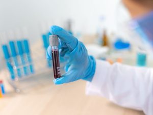 Profissional de saúde segura tubo com exame de sangue na mão direita